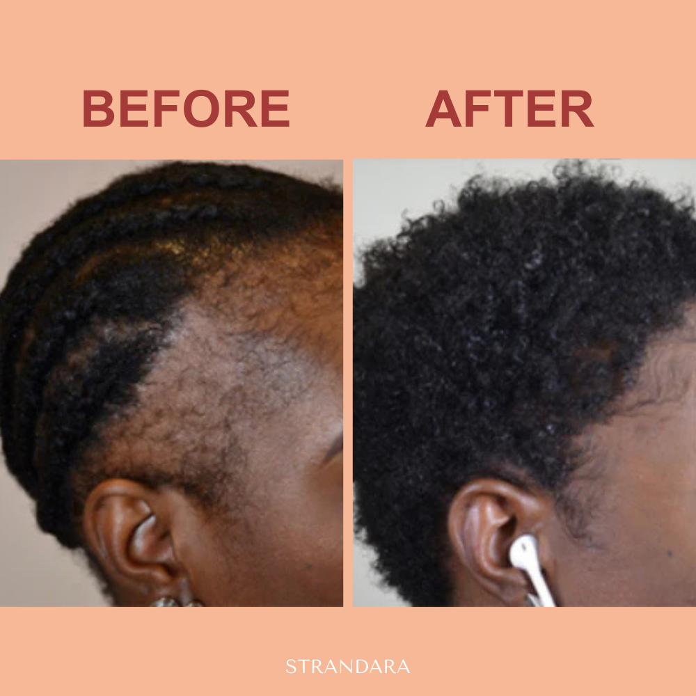 Batana Hair Growth Oil – Fuller Hair in 21 Days