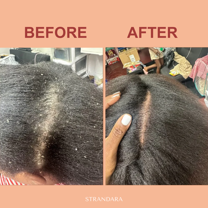 Batana Hair Growth Oil – Fuller Hair in 21 Days