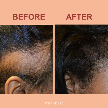 Batana Hair Growth Oil – Fuller Hair in 21 Days