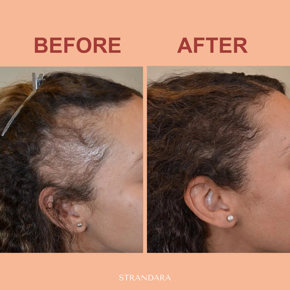 Batana Hair Growth Oil – Fuller Hair in 21 Days